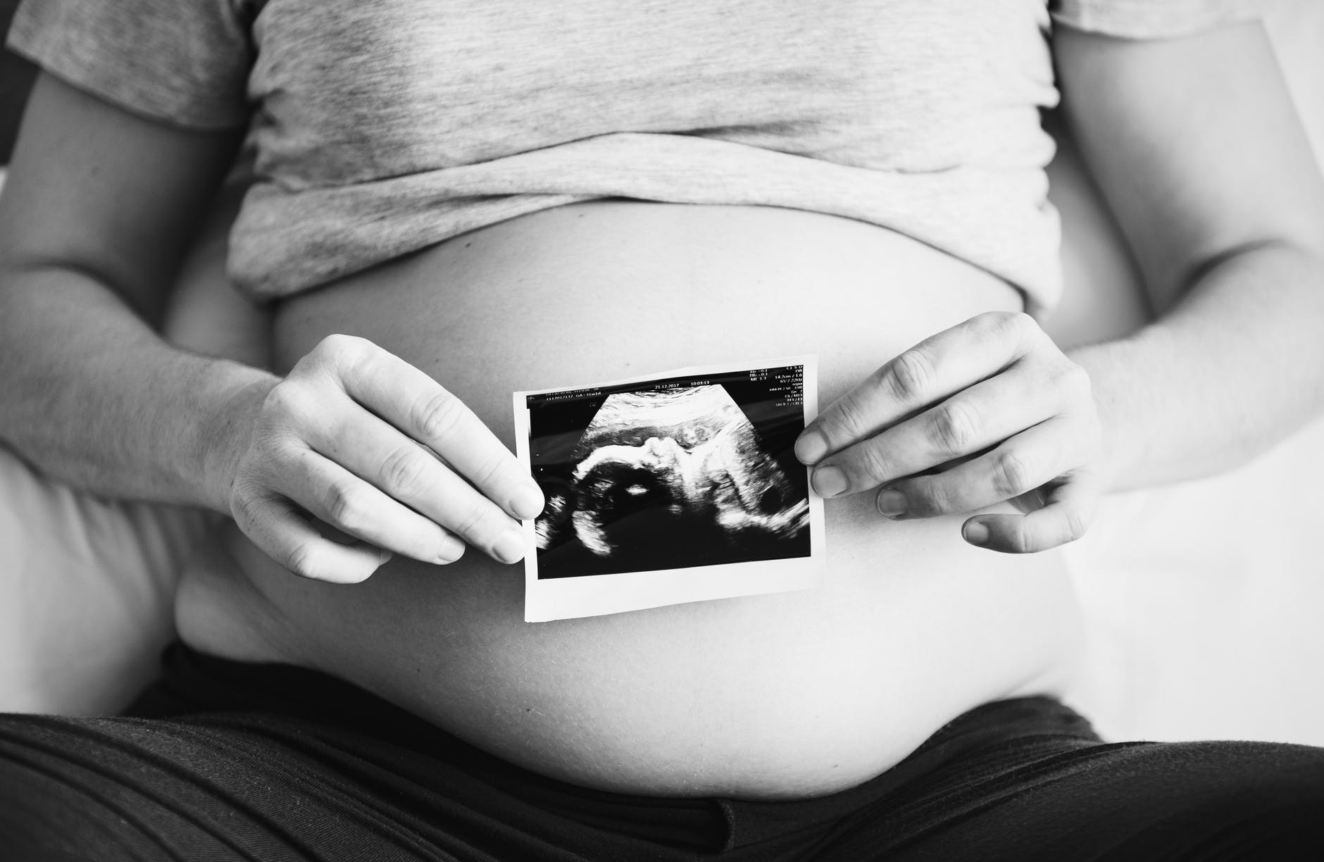 What should I know about 3D/4D ultrasounds? And How to Prepare for it?